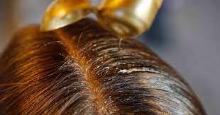Khadi Amla hair oil. Ayurvedic hair herbs